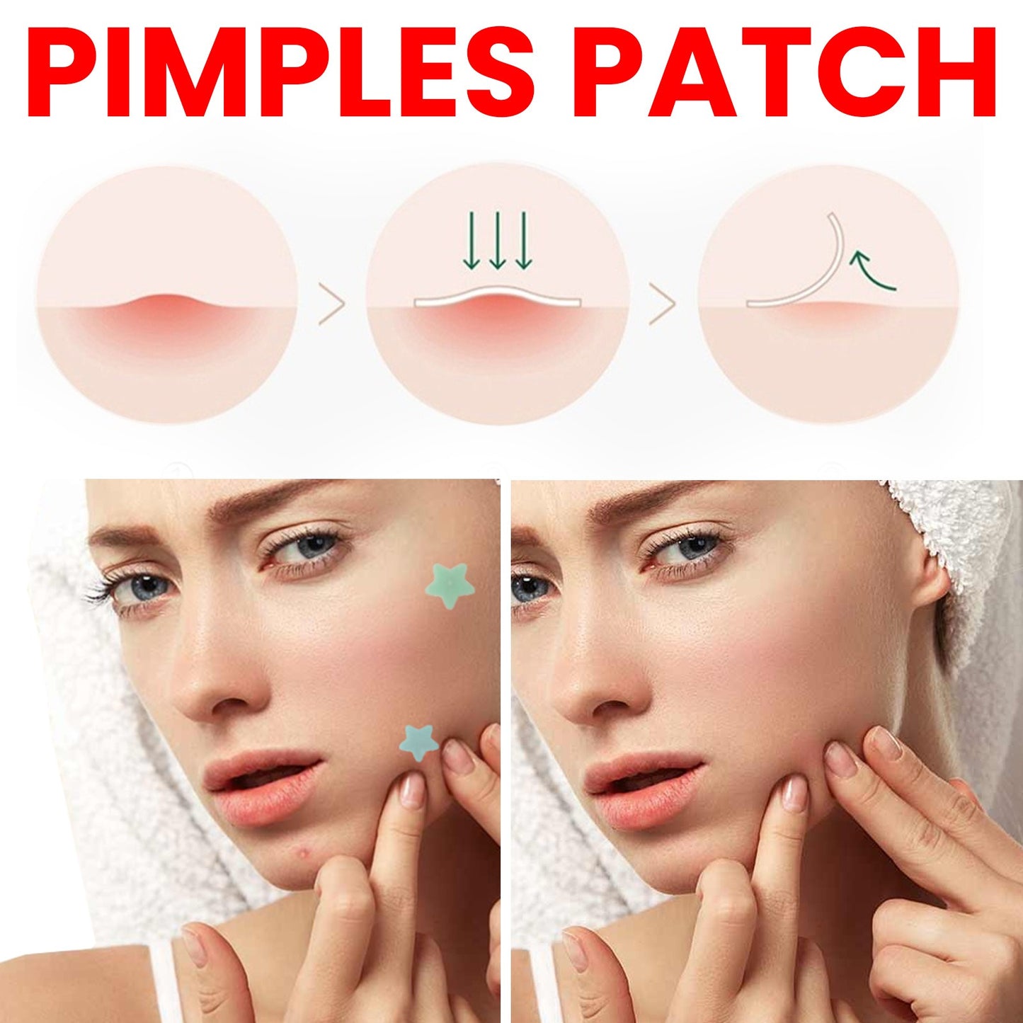 JaysuingRepair Acne Patch Facial Skin Care